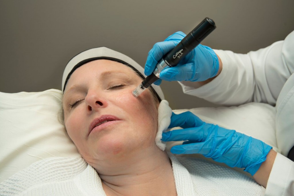 Microneedling with Collagen P.I.N.<