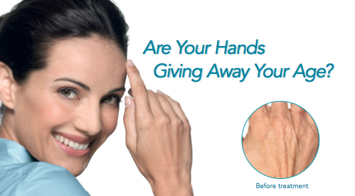 Are Your Hands Giving Away Your Age?