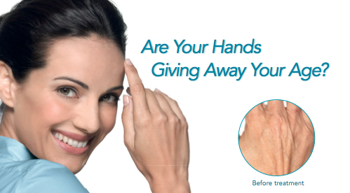 Are Your Hands Giving Away Your Age?<