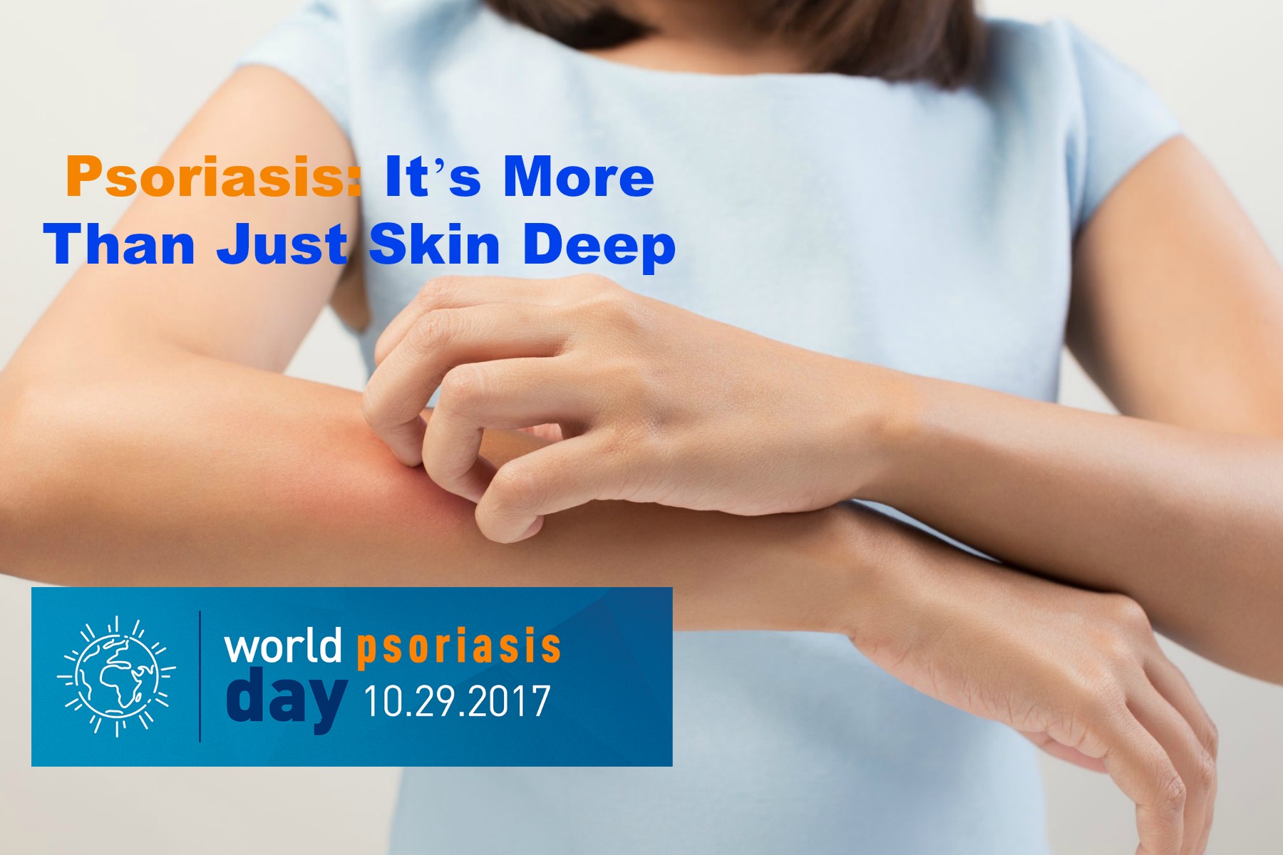 Psoriasis: It’s More Than Just Skin Deep