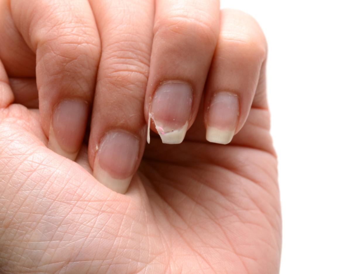 What Is Nail Slugging?