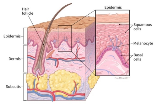 Skin Cancer Types